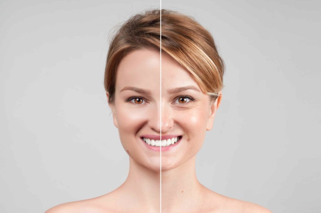 3 Tips For Reducing The Look Of Wrinkles And With The Help Of NEUROMODULATORS 2